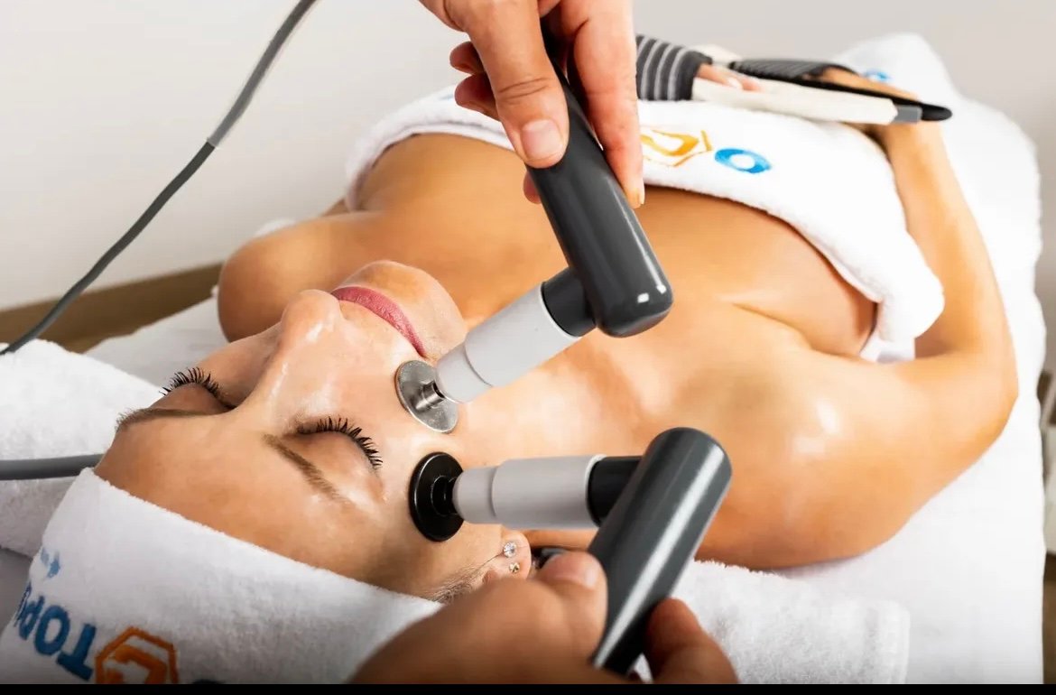 radiofrecuencia facial